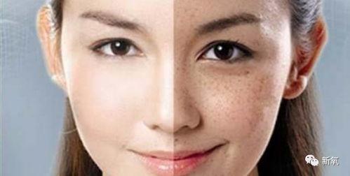 雀斑明星网红,揭秘网红明星的天然美颜秘诀”